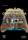TOMOGRAFA COMPUTARIZADA DIRIGIDA A TCNICOS SUPERIORES EN IMAGEN PARA EL DIAGN